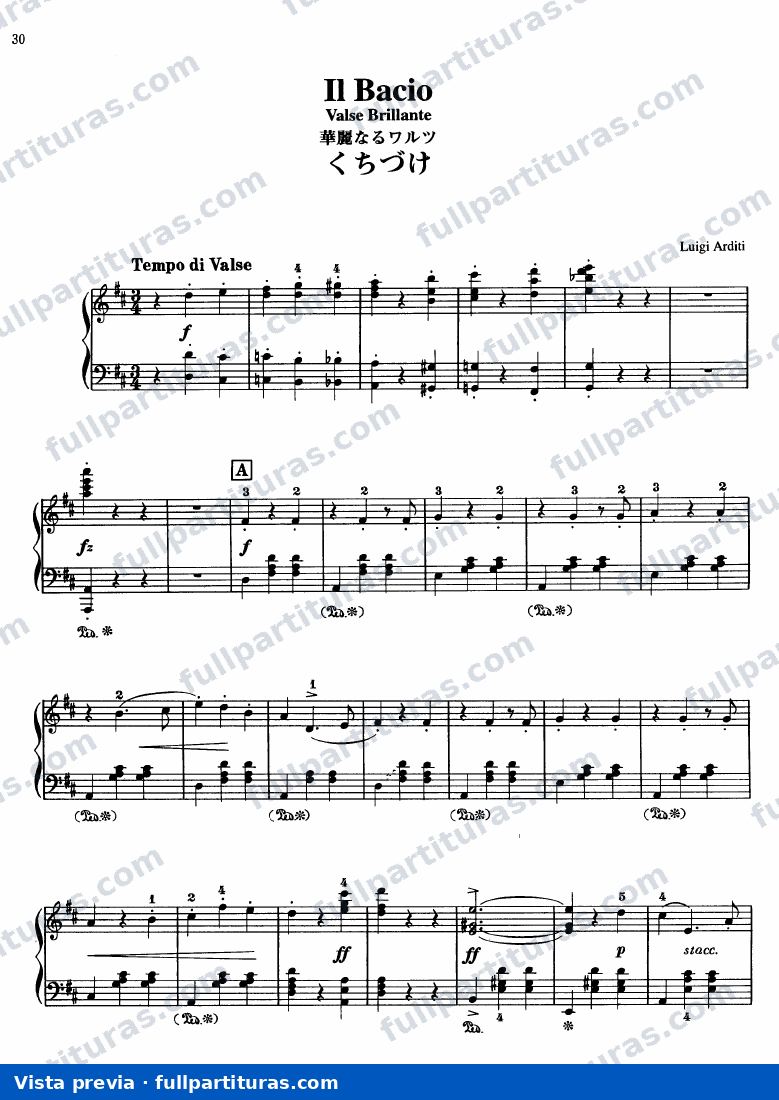 Il Bacio — preview