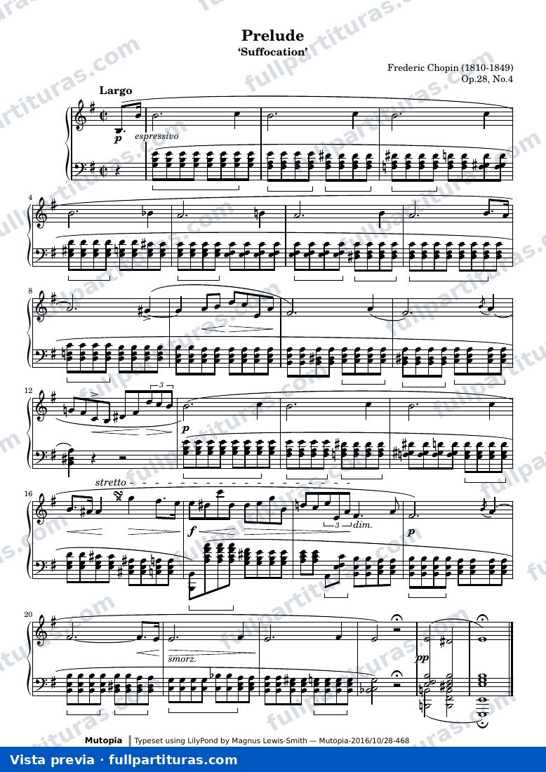Preludio Op. 28, No. 4 (Asfixia) — preview